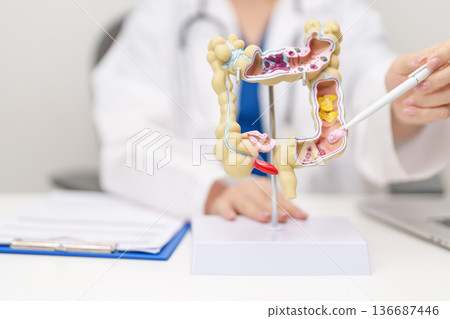 Doctor with human Colon anatomy model. Colonic disease, Large Intestine, Colorectal cancer, Ulcerative colitis, Diverticulitis, Irritable bowel syndrome, Digestive system and Healthcare concept 136687446