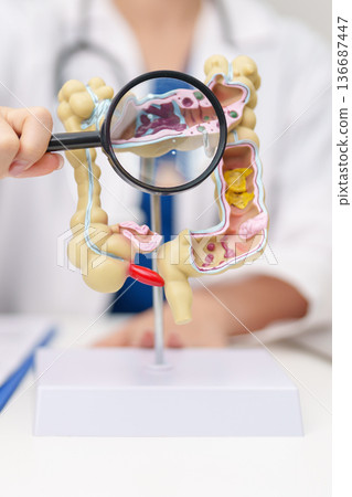 Doctor with human Colon anatomy model. Colonic disease, Large Intestine, Colorectal cancer, Ulcerative colitis, Diverticulitis, Irritable bowel syndrome, Digestive system and Healthcare concept Doctor with human Colon anatomy model. Colonic disease, Large Intestine, Colorectal cancer, Ulcerative colitis, Diverticulitis, Irritable bowel syndrome, Digestive system and Healthcare concept 136687447