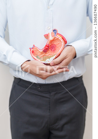 Man having abdomen pain or Stomachache with Gastric anatomy model. stomach diseases and ulcers, Gastroesophageal Reflux, November stomach cancer, Gastroenterologist consultation and Acid reflux 136687490