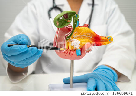 Pancreatitis, pancreatic cancer, Asian doctor with pancreas, gallbladder and bile duct human anatomy model at hospital. 136699671