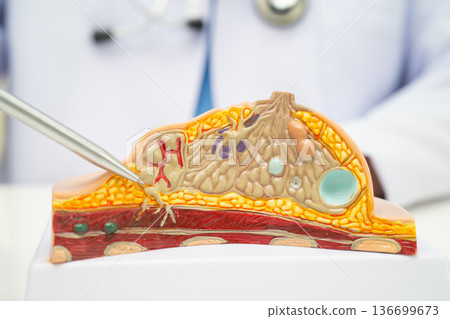 doctor holding female breast human anatomy model. doctor holding female breast human anatomy model. 136699673
