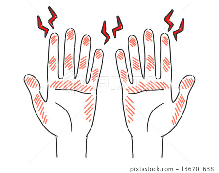 Hand care, rough hands, troubled hands, vector 136701638