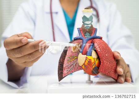 Pneumonia, lung cancer, Asian doctor holding human anatomy model for study diagnosis and treatment in hospital. 136702715