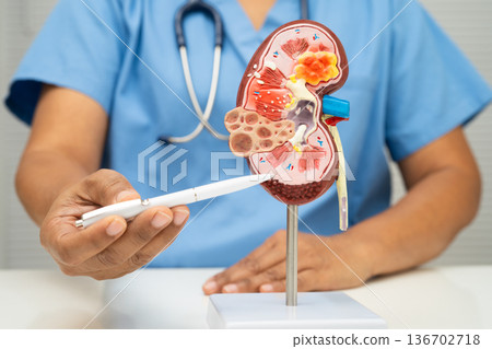 Chronic kidney disease, doctor with model for treatment urinary system, urology, Estimated glomerular filtration rate eGFR. Chronic kidney disease, doctor with model for treatment urinary system, urology, Estimated glomerular filtration rate eGFR. 136702718
