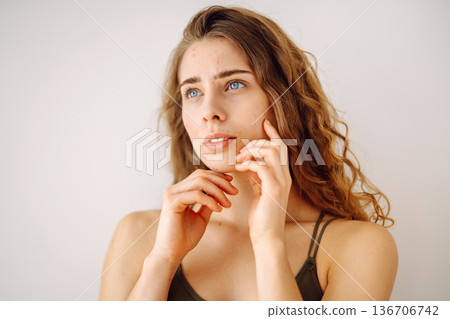 Woman no make up with red spots on her face. Health problem, skin diseases. Medicine and cosmetology Woman no make up with red spots on her face. Health problem, skin diseases. Medicine and cosmetology 136706742
