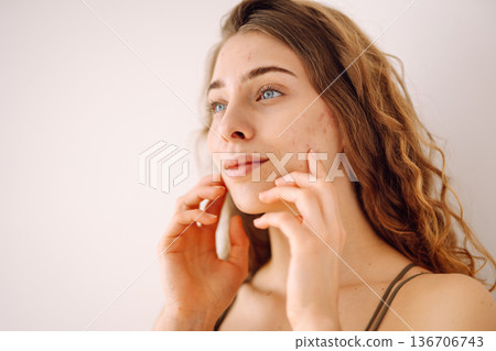 Woman no make up with red spots on her face. Health problem, skin diseases. Medicine and cosmetology Woman no make up with red spots on her face. Health problem, skin diseases. Medicine and cosmetology 136706743