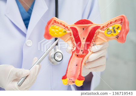 Uterus, doctor holding human anatomy model for study diagnosis and treatment in hospital. Uterus, doctor holding human anatomy model for study diagnosis and treatment in hospital. 136719543