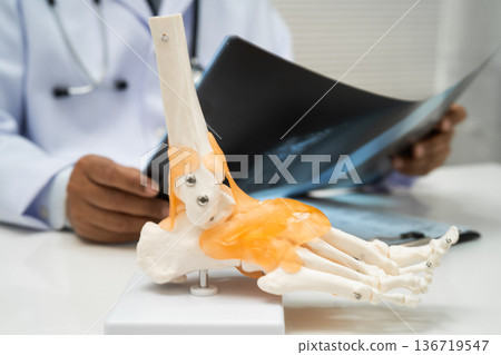 Doctor examining foot ankle  joint bone radiography xray film. 136719547