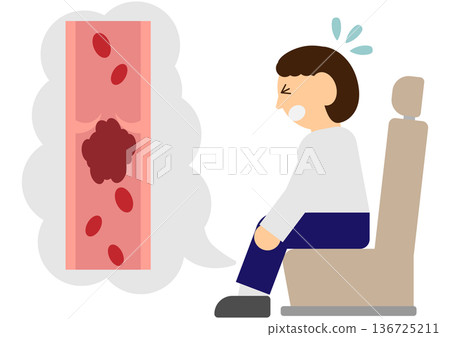 Illustration material of a man whose legs hurt from being in the same position for a long time and economy class syndrome caused by a blood clot in the venous valve 136725211