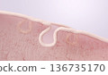 Illustration of the skin structure mechanism of collagen deterioration and sagging pores due to aging 136735170