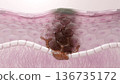 Cross-section of skin where melanocytes produce melanin, resulting in pigmentation and age spots 136735172
