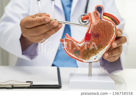 Stomach disease, doctor with anatomy model for study diagnosis and treatment in hospital. Stomach disease, doctor with anatomy model for study diagnosis and treatment in hospital. 136738558