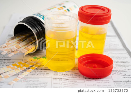 Urinalysis, urine cup with reagent strip pH paper test and comparison chart in laboratory. 136738570
