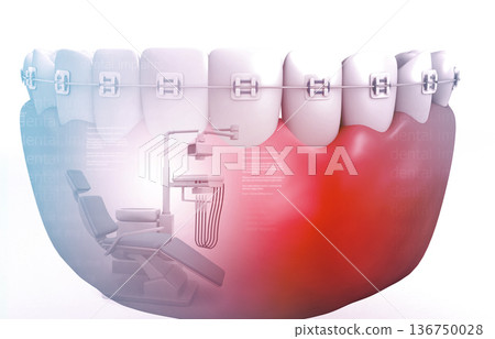Human tooth with orthodontic braces 136750028