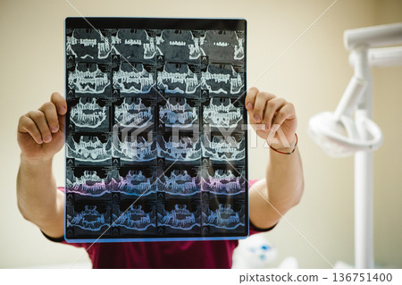 Dentist holding a panoramic dental X-ray of teeth. Dentist holding a panoramic dental X-ray of teeth. 136751400