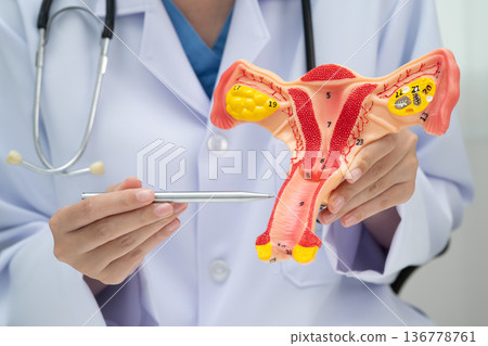 Uterus, doctor holding human anatomy model for study diagnosis and treatment in hospital. Uterus, doctor holding human anatomy model for study diagnosis and treatment in hospital. 136778761