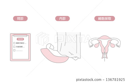 解釋子宮頸癌篩檢過程(訪談、骨盆檢查、細胞學檢查)的醫學插圖 解釋子宮頸癌篩檢過程(訪談、骨盆檢查、細胞學檢查)的醫學插圖 136781925