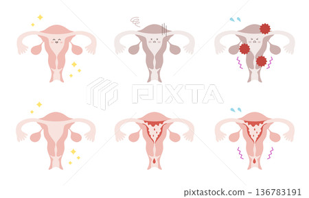 Set of uterus illustrations in various states 136783191