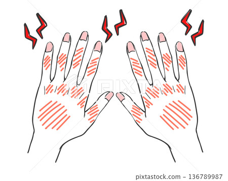 Hand care, rough hands, troubled hands, vector 136789987