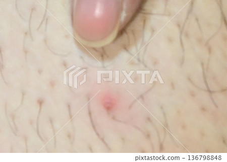 帶有尖峰狀突起的病毒和病原體的圖像材料 帶有尖峰狀突起的病毒和病原體的圖像材料 136798848