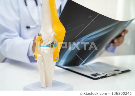 Doctor examining knee joint bone radiography xray film. 136800245