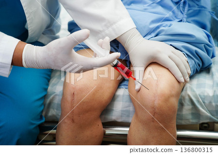 Asian doctor inject Hyaluronic acid platelet rich plasma into knee of senior woman. Asian doctor inject Hyaluronic acid platelet rich plasma into knee of senior woman. 136800315