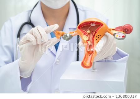 Uterus, doctor holding human anatomy model for study diagnosis and treatment in hospital. Uterus, doctor holding human anatomy model for study diagnosis and treatment in hospital. 136800317