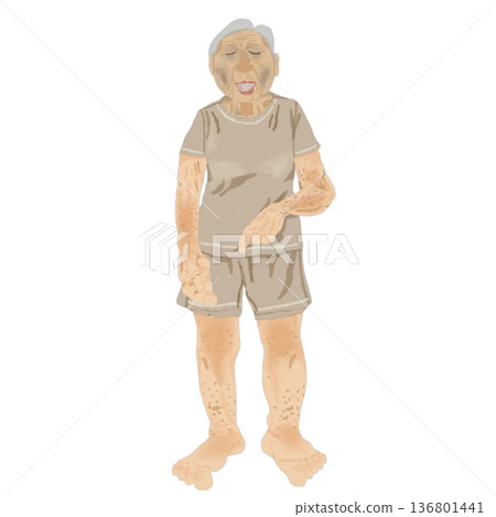 老年人脫水檢查 | 全身體徵及觀察點的醫學插圖 136801441