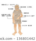 老年人脫水檢查 | 全身體徵及觀察點的醫學插圖 136801442