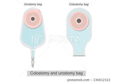 Colostomy and urostomy bag on abdomen isolated on white background. 136812322