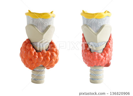 Thyroid gland human anatomy model isolated on white background with clipping path, Hyperthyroidism, Overactive Thyroid, Thyroid Lymphoma. 136820906