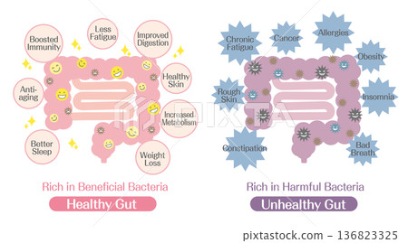 Illustration comparing intestinal flora (intestines with many good bacteria and intestines with many bad bacteria) Illustration comparing intestinal flora (intestines with many good bacteria and intestines with many bad bacteria) 136823325