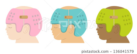 Illustration of Black, Caucasian, and Asian babies wearing helmets to correct head shape Illustration of Black, Caucasian, and Asian babies wearing helmets to correct head shape 136841579