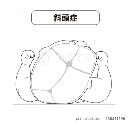 Sleeping posture: The mechanism by which the head shape of a baby is distorted depending on the direction of the head while sleeping, plagiocephaly, brachycephaly, dolicocephaly Sleeping posture: The mechanism by which the head shape of a baby is distorted depending on the direction of the head while sleeping, plagiocephaly, brachycephaly, dolicocephaly 136841596