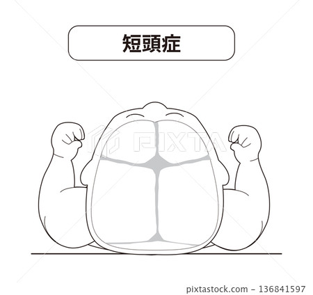 嬰兒頭部形狀會因睡眠時頭部位置而扭曲,包括斜頭畸形、短頭畸形和長頭畸形。 嬰兒頭部形狀會因睡眠時頭部位置而扭曲,包括斜頭畸形、短頭畸形和長頭畸形。 136841597
