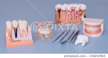 Dental implant and tooth anatomy training models with dentist instruments on blue background Dental implant and tooth anatomy training models with dentist instruments on blue background 136850964
