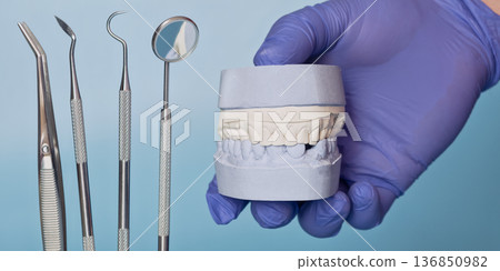 Dental Plaster Cast Jaw Model with Dentist Instruments in Blue Medical Glove on Light Blue Background, Prosthodontic Laboratory Concept 136850982