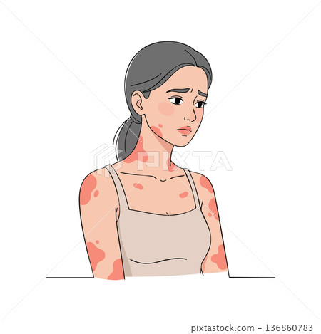 Woman with skin rash on face and body showing symptoms of allergy or illness in vector style illustration 136860783