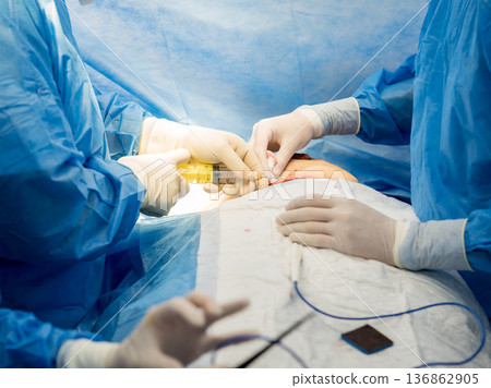 Surgery to remove the breast and replace it with an implant. Surgery to remove the breast and replace it with an implant. 136862905