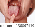 Closeup Open Mouth Revealing Tongue Texture, Finger Gently Pressing Tip, Clinical Lighting, Visible Teeth And Mucosa, Moist Surface Highlighting Papillae And Coating, Clinical Concern 136867419