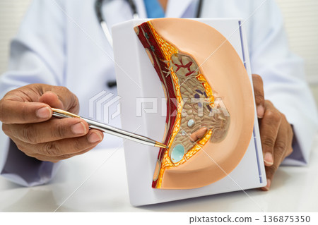 doctor holding female breast human anatomy model. doctor holding female breast human anatomy model. 136875350