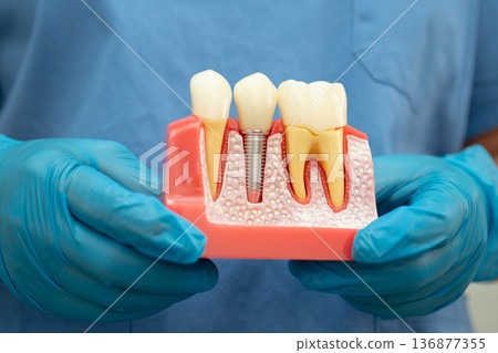 Teeth root dental model with tool for dentist use to cleaning care treatment. Teeth root dental model with tool for dentist use to cleaning care treatment. 136877355