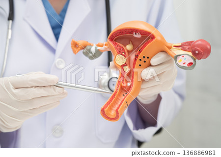 Uterus, doctor holding human anatomy model for study diagnosis and treatment in hospital. 136886981