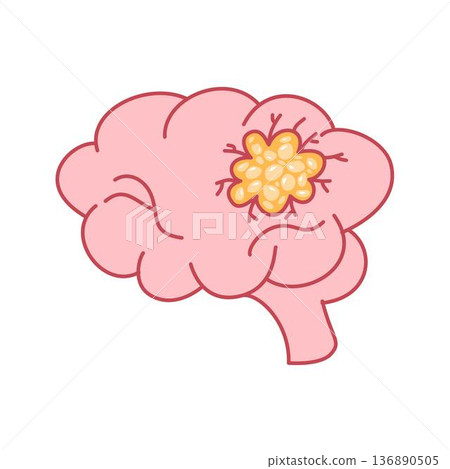 Brain Cancer, Stroke disease. Hemorrhagic brain stroke concept. Apoplexy, Brain Tumor Brain Cancer, Stroke disease. Hemorrhagic brain stroke concept. Apoplexy, Brain Tumor 136890505