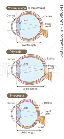 Diagram of the structure of the eye and refractive errors (normal, nearsighted, farsighted) 136906641