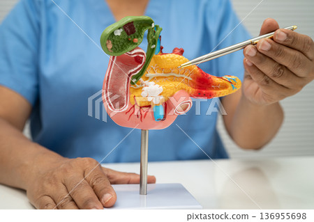 Pancreatitis, pancreatic cancer, Asian doctor with pancreas, gallbladder and bile duct human anatomy model at hospital. Pancreatitis, pancreatic cancer, Asian doctor with pancreas, gallbladder and bile duct human anatomy model at hospital. 136955698