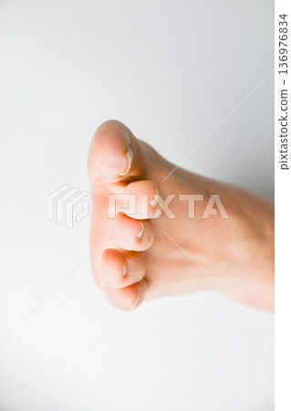腳趾甲出現嵌甲或內生甲的症狀 腳趾甲出現嵌甲或內生甲的症狀 136976834