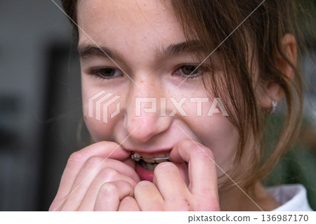 Happy patient with removable orthodontic plate, smile correction for children, close-up of appliance fitting. 136987170