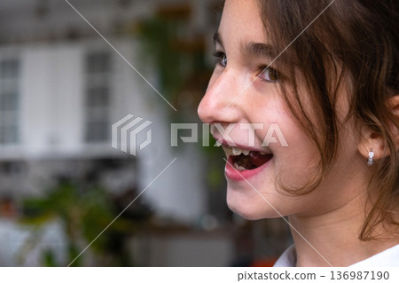 Portrait: girl age 9 after early orthodontic intervention, showing beautiful healthy smile. Portrait: girl age 9 after early orthodontic intervention, showing beautiful healthy smile. 136987190
