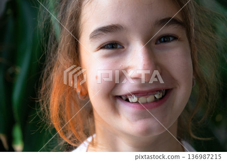 Smiling girl after early intervention orthodontics, healthy teeth and visible correct jaw arch. 136987215